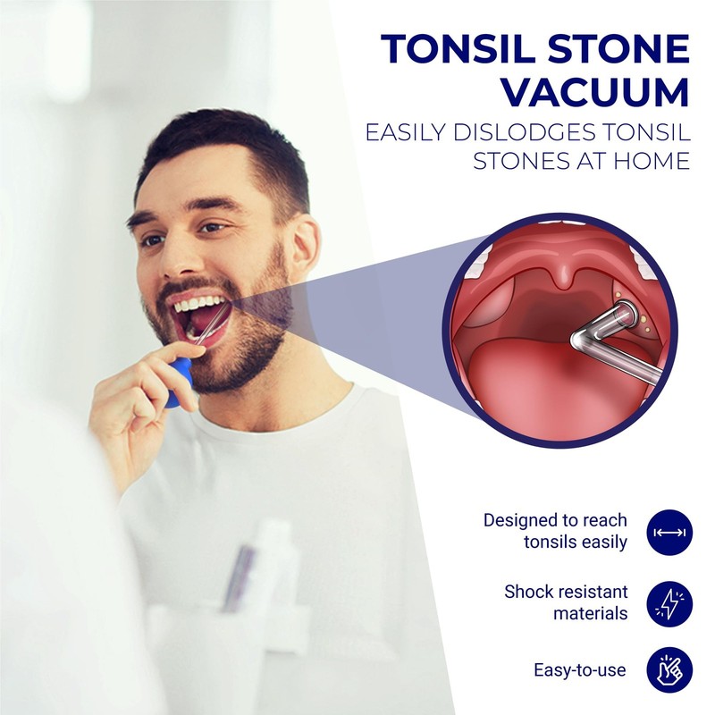 Oravix Tonsil Stone Vacuum, Remover Vacuum Suction, Tonsil... gallery