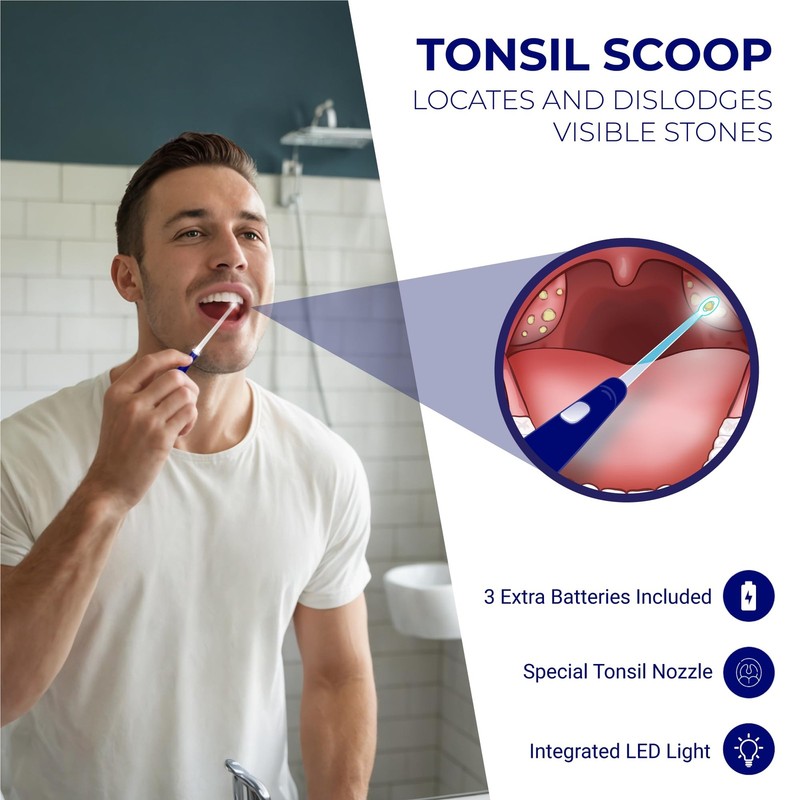 Oravix Tonsil Stone Vacuum, Remover Vacuum Suction, Tonsil... gallery